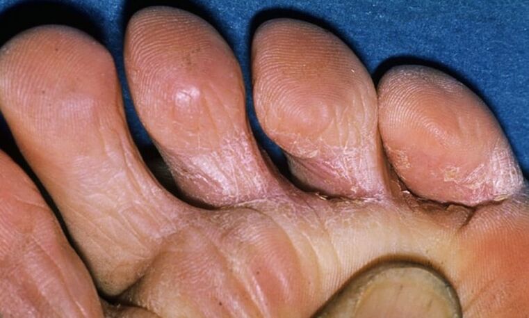 Divers types de jambes des jambes